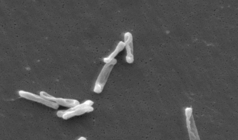 CIHR grant name: C. difficile Near-Patient Testing Versus Centralized Laboratory Testing: A Cluster Randomized Trial. 