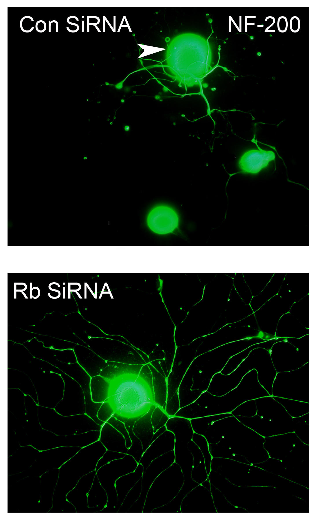 Adult neurons are seen without (top) and following (below) treatment to inactivate Rb. Following treatment, the neurons show an increase in growth (branching) of axons.