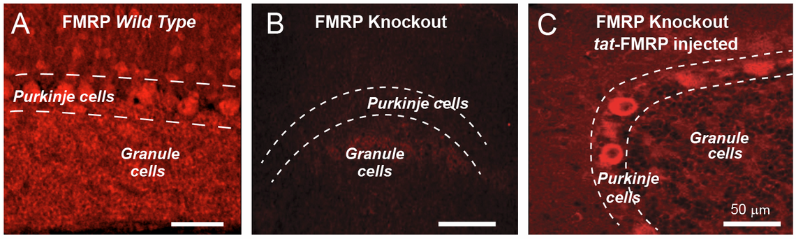 Extensive FMRP expression in normal brain (A) is missing in FMRP knockout mice (B) but restored 1 hr after tat-FMRP injection (C). 