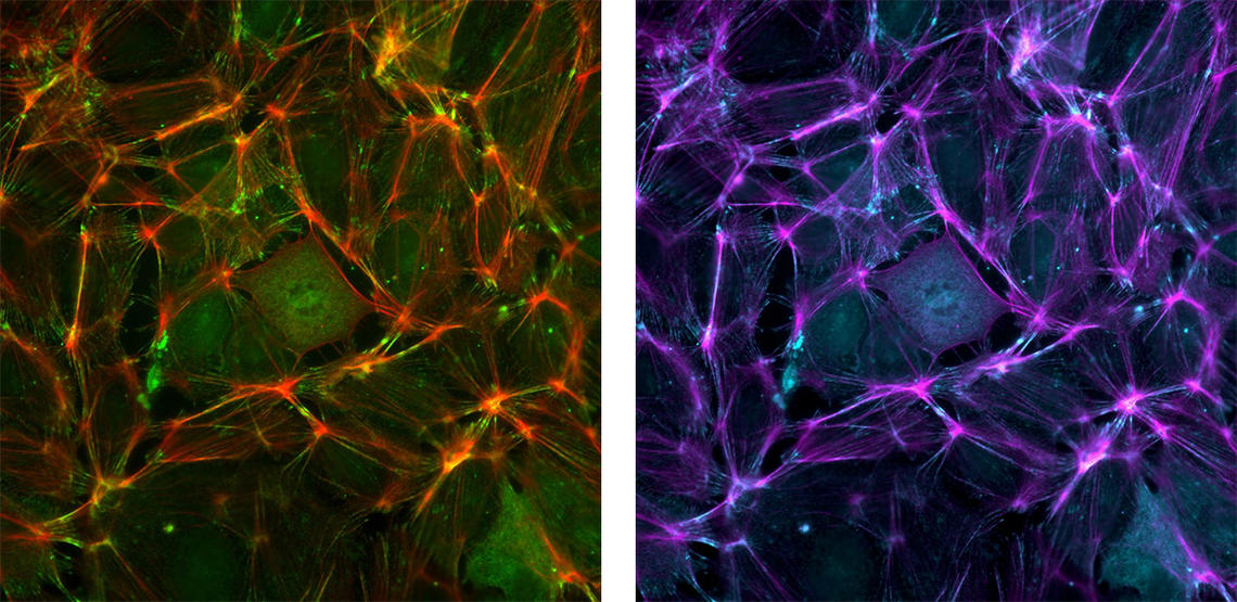 These are images of endothelial cells that line the blood vessels. The first uses standard red to label actin and green to label a focal adhesion protein. The second is the same image using magenta and cyan instead