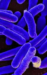 Resistance to antibiotics is on the rise worldwide because of the overuse and misuse of medications, which can also lead to other health issues like drug toxicity or complications. “Microbe” by NIAID via Foter.com is licensed under CC by 2.0.