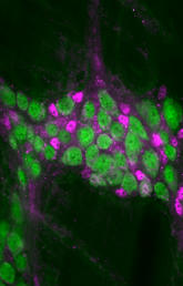 Enteric neurons and glial cells in the myenteric plexus of the colon in an animal after natural microbial recolonization of the gut following antibiotic treatment.