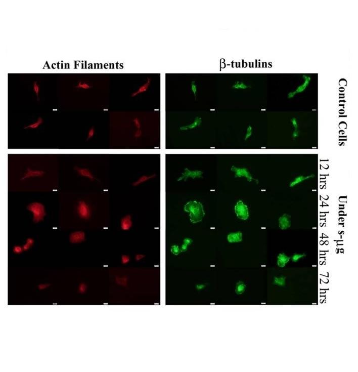 Impact of simulated microgravity on cytoskeleton and viscoelastic properties of endothelial cell