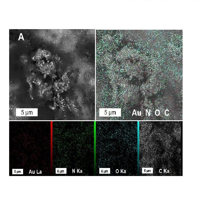 A novel graphene-grafted gold nanoparticles composite for highly sensitive electrochemical biosensing