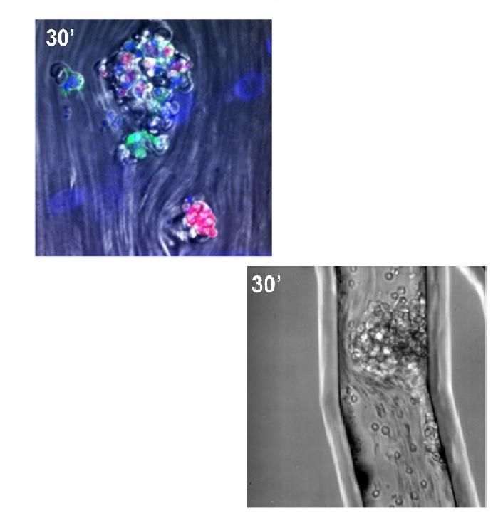 Leukotriene B4-mediated neutrophil recruitment causes pulmonary capillaritis during lethal fungal sepsis