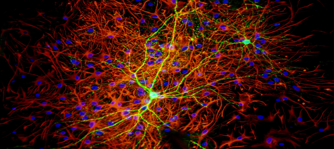 Neuronal culture