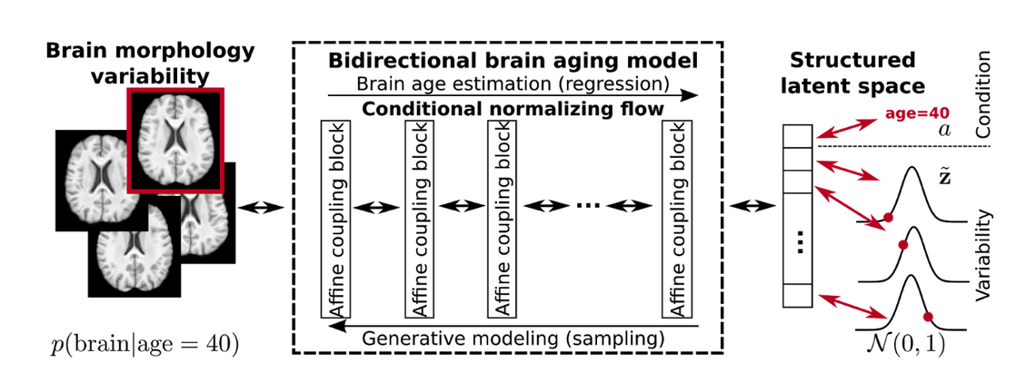 bidirectional model