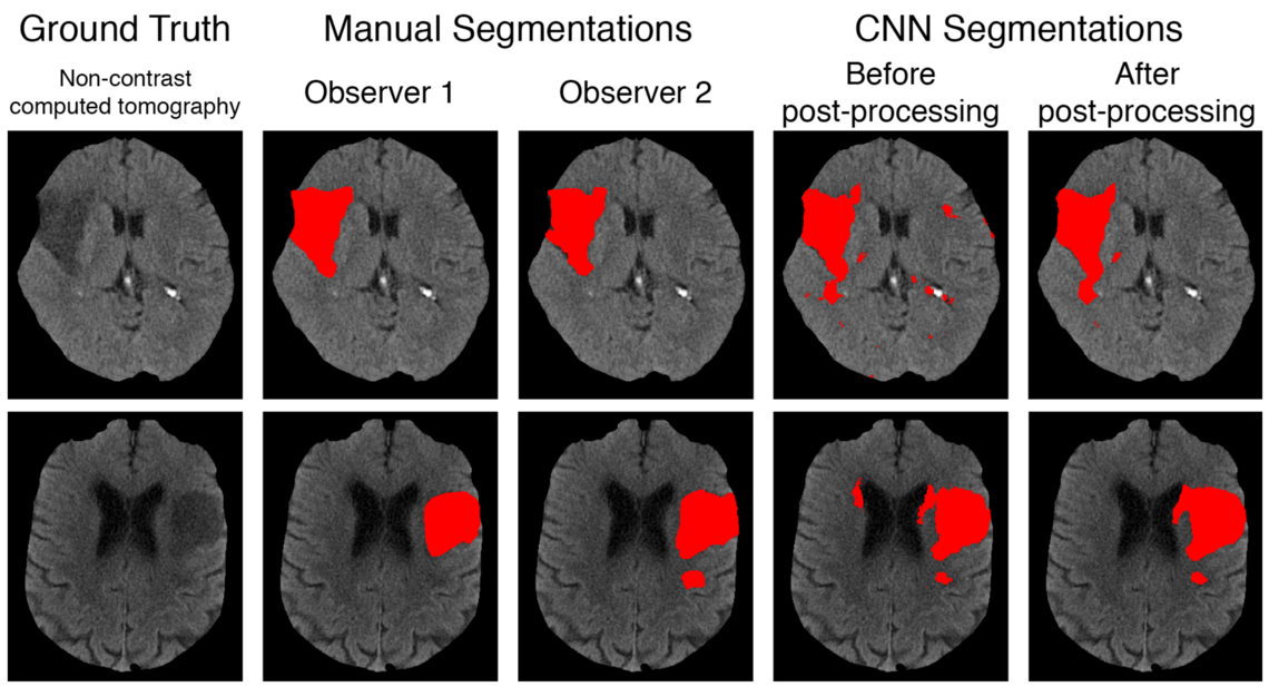 segmentation