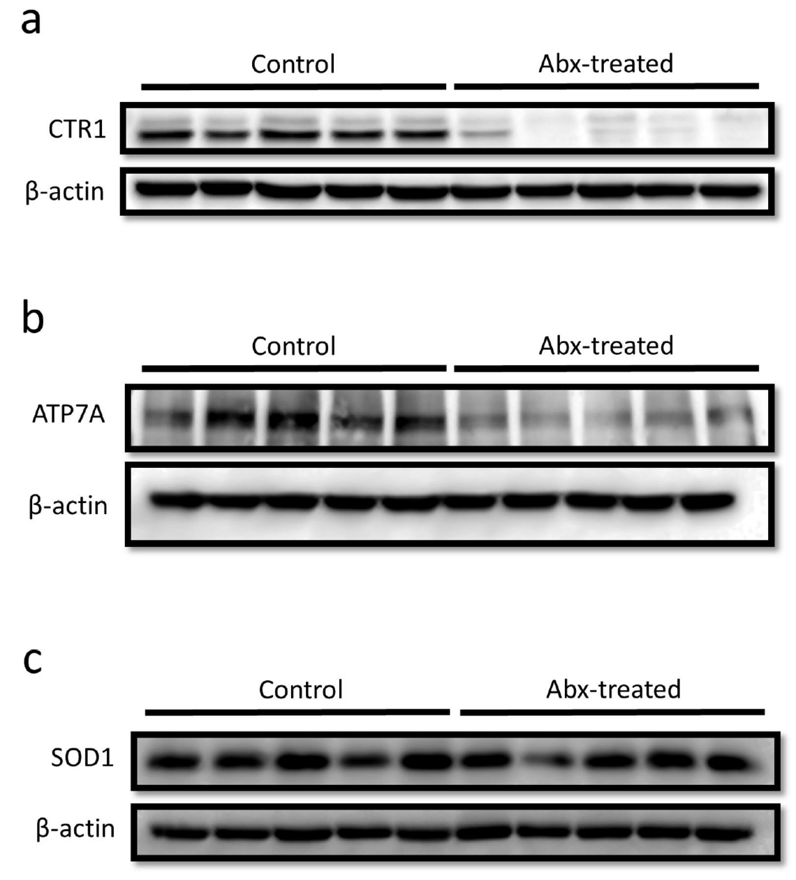 Series of Western blots that show the expressions of the different proteins. 